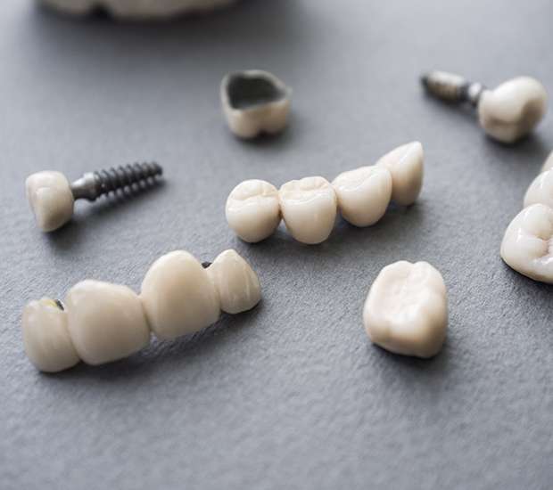 Temecula The Difference Between Dental Implants and Mini Dental Implants