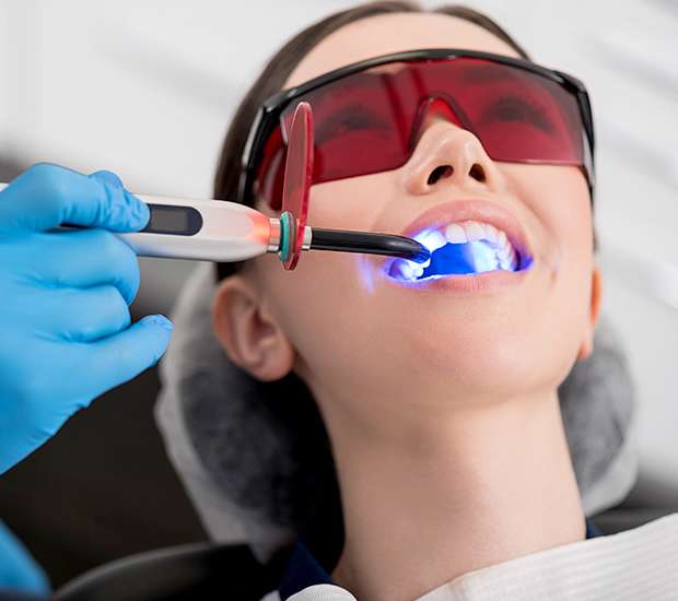 Temecula Professional Teeth Whitening